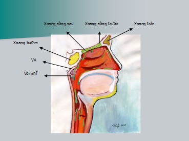 Bài Thuốc Chữa Viêm Xoang. Viêm Mũi Dị Ứng Tận Gốc Không Tái Phát